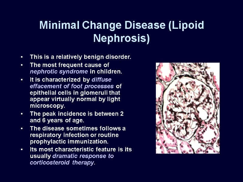 Minimal Change Disease (Lipoid Nephrosis) This is a relatively benign disorder. The most frequent